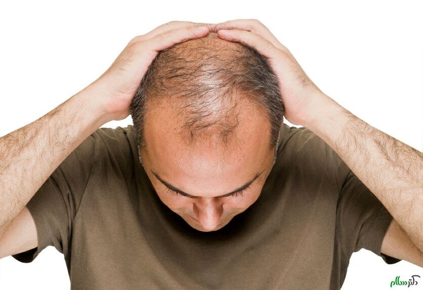 درمان سریع ریزش مو، کذب محض است