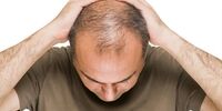 چند راهکار ساده برای پر پشت کردن موها