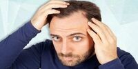 اگر نگران ریزش موی خود هستید، این چند نکته را جدی بگیرید