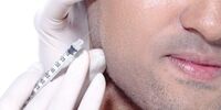 زاویه سازی فک و صورت به روش تزریق ژل و تزریق چربی