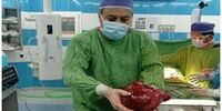 خروج تومور ۳.۵ کیلویی از کلیه یک بیمار ۵۱ ساله!+عکس