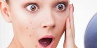 به این دلیل بر روی پیشانی و گونه جوش می زنیم 