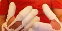 شکایت از شرکت سونی به دلیل انفجار تلفن همراه