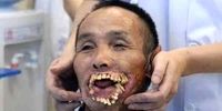تصویری دلخراش از مردی که گرگ دهانش را خورد!+عکس