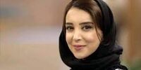 تغییر چهره باورنکردنی سحر جعفری جوزانی بعد از جراحی زیبایی