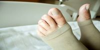 علائم هشداردهنده لخته‌ شدن خون در پا