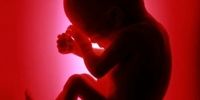 جلوگیری از تولد ۲۵۰۰۰ معلول با مشاوره ژنتیک و سقط درمانی؛ احتمال سونامی معلولیت ژنتیکی در ایران