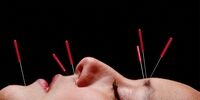 طب سوزنی در درمان نا باروری معجزه می کند