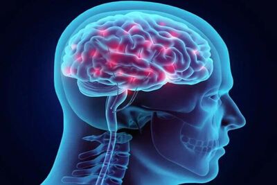 دو دلیل اصلی ابتلا به آلزایمر؛چرا تهرانی ها بیشتر در معرض خطر هستند