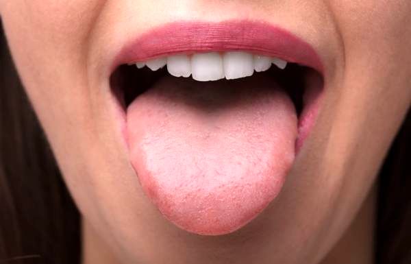  خال این رنگی داخل دهان یعنی سرطان زبان !

