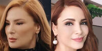 بلایی که بر سر چهره زیبای بازیگر معروف ترک آمد+ عکس
