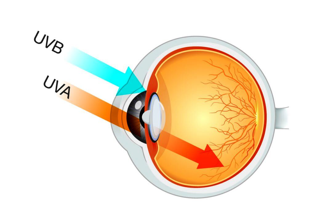 اشعه ماورا بنفش باعث چه بیماری‌هایی می‌شود ؟ + راهکارهای محافظتی در برابر اشعه UV