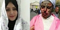 شهروندان ایرانی به یاری معصومه شتافتند/ مهربانی مردم سوختگی اسید را ترمیم می‌کند؟