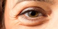 عامل جلوگیری از کاهش بینایی در پیری