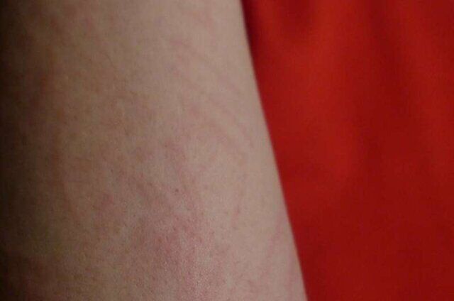 جدیدترین یافته های پژوهشگران درباره اولین علائم ابتلا به کرونا