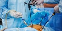 افرادی که BMI آن ها این اعدد باشد، بهترین کاندید جراحی لاغری هستند