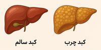 این 4 میوه برای کبد ضرر دارد 