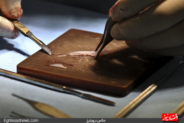 جراحی بینی در ایران از دریچه دوربین رویترز (گزارش تصویری)