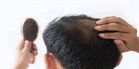 اگر ریزش مو دارید؛ به این بیماری ها مبتلا شدید