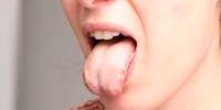 سوزش زبان نشانه این بیماری‌  خطرناک است؛ جدی بگیرید