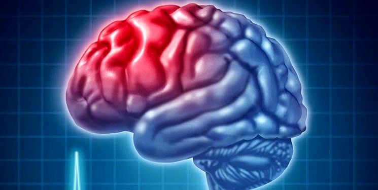 زمان طلایی درمان سکته مغزی چقدر است؟