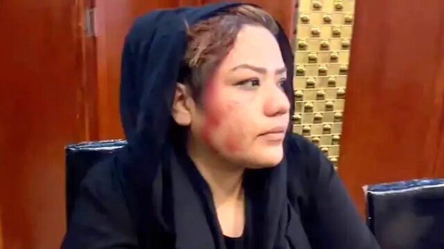 طالبان به اعتراضات زنان در کابل حمله کرد/ یک زن مجروح شد