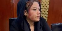 طالبان به اعتراضات زنان در کابل حمله کرد/ یک زن مجروح شد