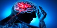 جلوگیری از سکته مغزی با یک فناوری جدید