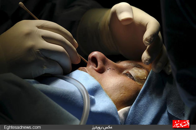 جراحی بینی در ایران از دریچه دوربین رویترز (گزارش تصویری)