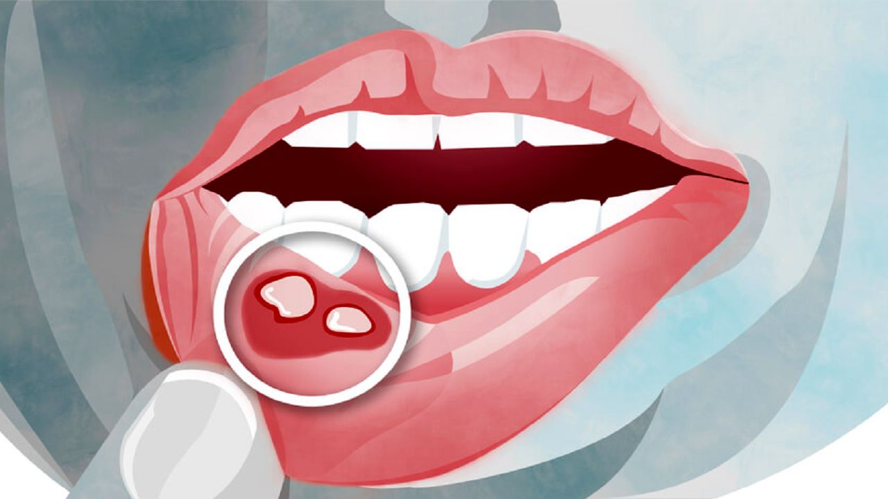 نشانه های مشکل دستگاه گوارش در دهان
