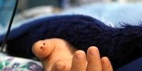 مرگ فجیع کودک ۸ ساله بر اثر انفجار افشانه رنگ