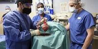 مرگ بیمار ی که قلب خوک را به او پیوند زده بودند+عکس