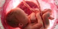 لیستی از غذاهایی که باعث سقط جنین می شوند