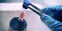 نیاز آزمایشگاه‌ها با این کیت‌های تشخیصی ایرانی برطرف شد
