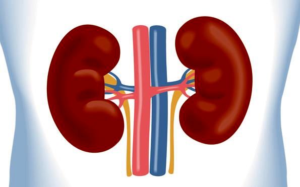 درمان فوری سنگ کلیه مشخص شد