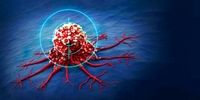 شناسایی سلول های قاتل سرطان با هوش مصنوعی