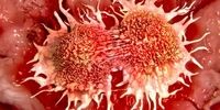 کشنده‌ترین سرطان کدام است؟