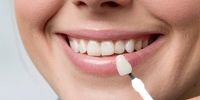 6  روش خانگی برای سفید کردن دندان‌ها