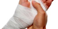 یک روش  ساده برای درمان سوختگی دست