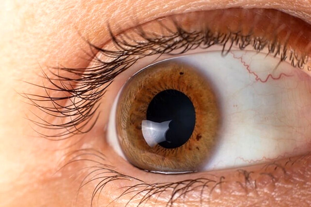 چشم ها خبر از این 6 بیماری خطرناک می دهند