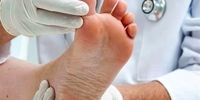 ارتباط بیماری‌ها با تغییرات ظاهری در ناحیه پا