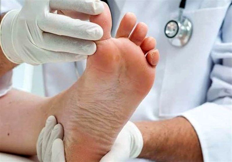 ارتباط بیماری‌ها با تغییرات ظاهری در ناحیه پا
