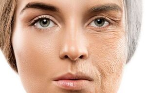 ۱۰ ماده غذایی مضر که پوست صورت را نابود می‌کنند
