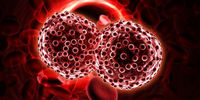 علائم سرطان خون؛ نشانه های خاموش سرطان خون را بشناسید
