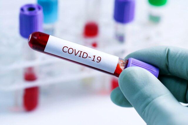 کدام آنتی بادی ها در درمان کووید-۱۹ موثر است؟