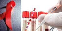 تست امیدبخش واکسن HIV