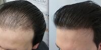 باورهای رایج نادرست درباره بهداشت و سلامت مو

