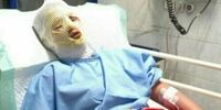 حادثه انفجار مواد محترقه 2 نفر را راهی بیمارستان کرد