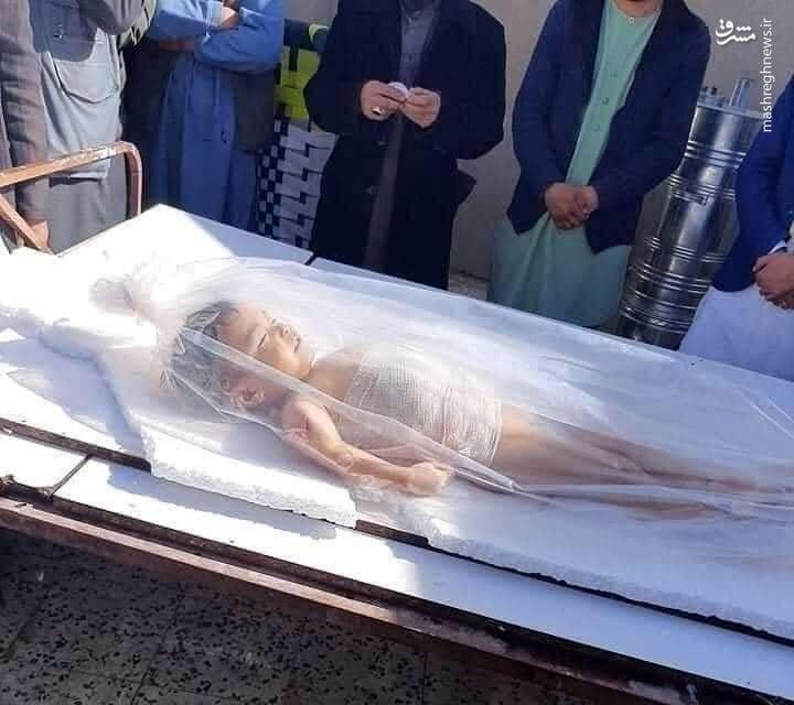 تصویری تلخ از کوچکترین شهید در انفجار کابل
