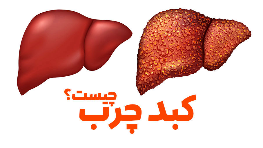 درمان فوری کبد چرب با این میوه‌ها